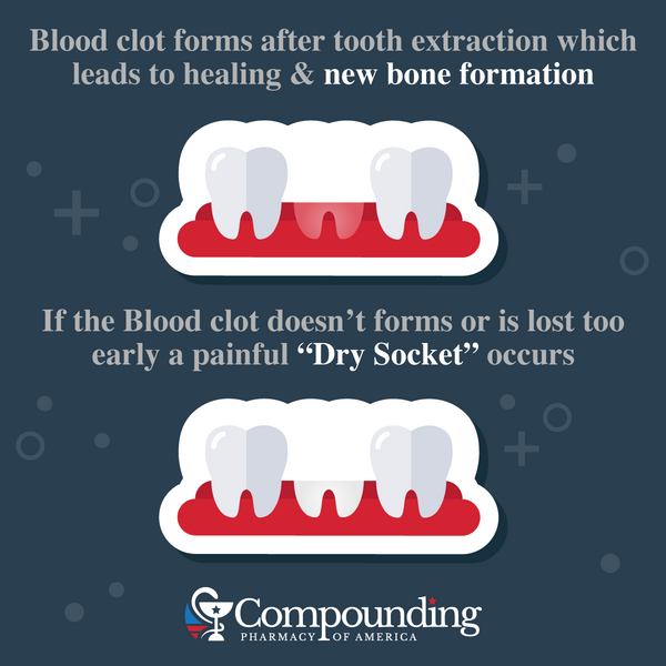 dry socket vs blood clot