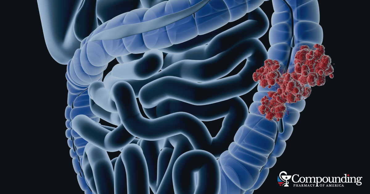 Are You Among Those at Increased Risk for Colorectal Cancer