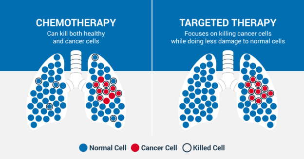 What Does It Mean If My Lung Cancer Is Inoperable?
