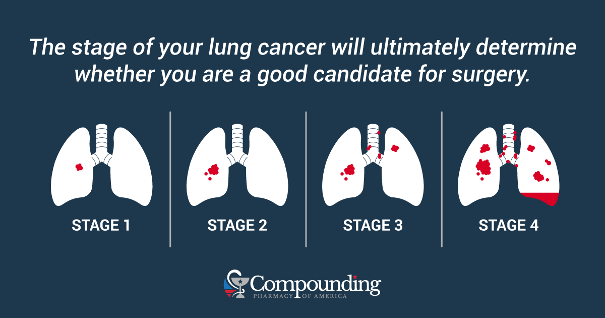 Stages of Lunch Cancer Graphic