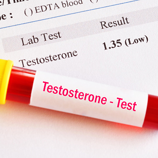 low testosterone test