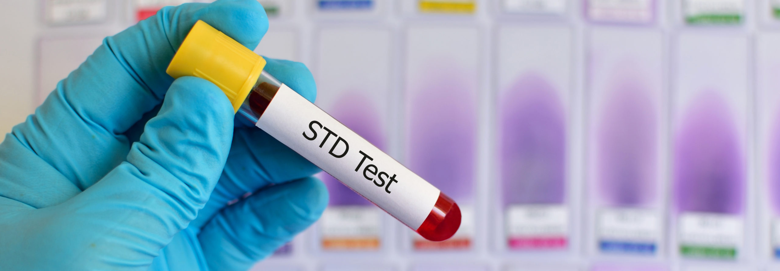 STD Test