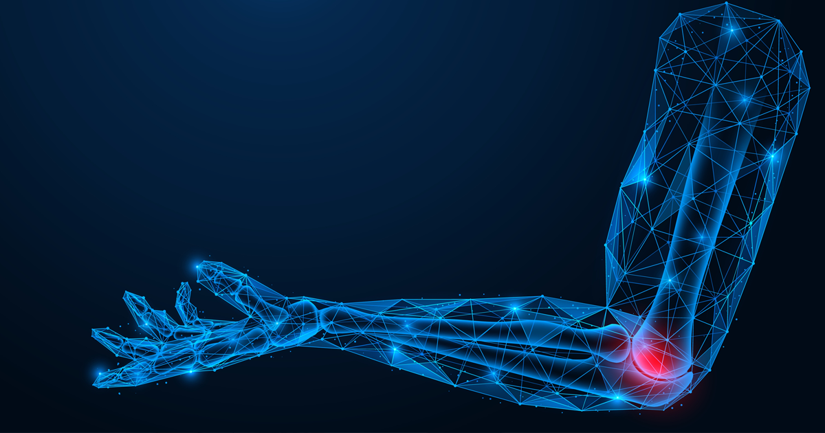 Combating Arthritis Inflammation