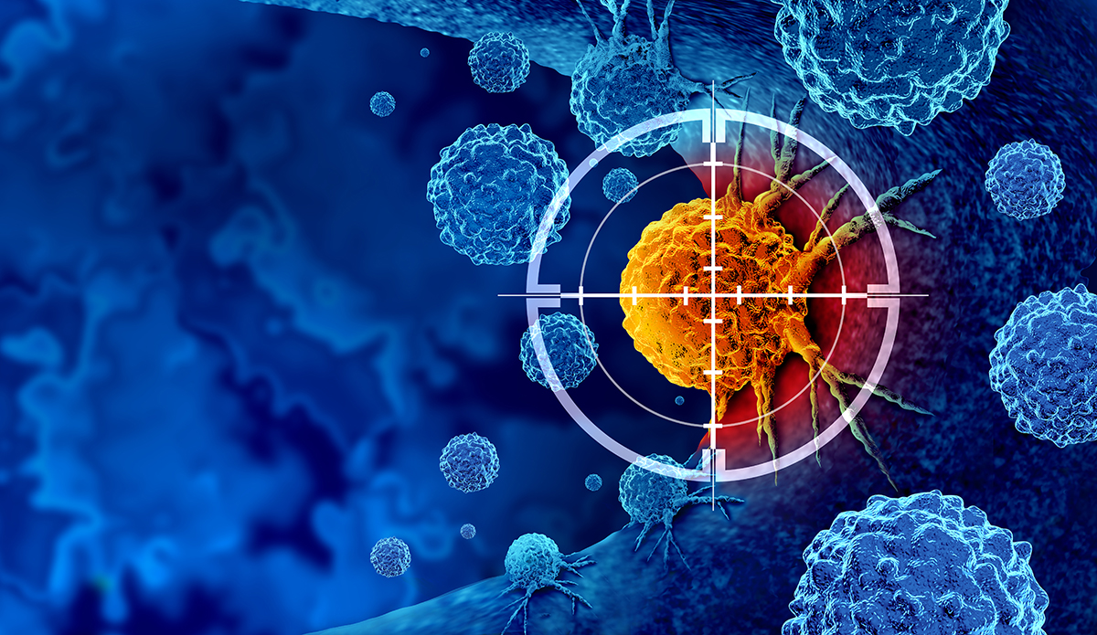 prostate cancer