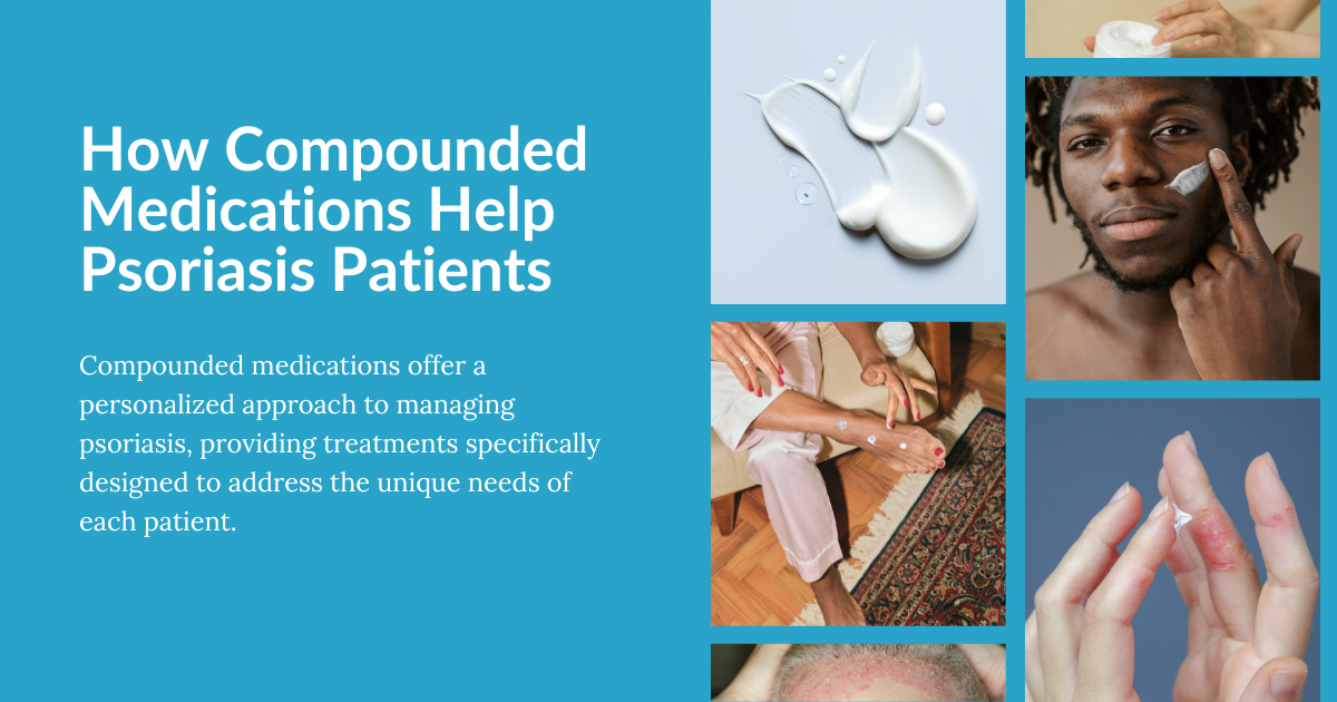 Compounded Medications for Psoriasis Patients