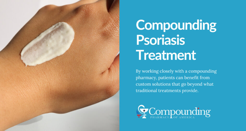 Compounding for Psoriasis