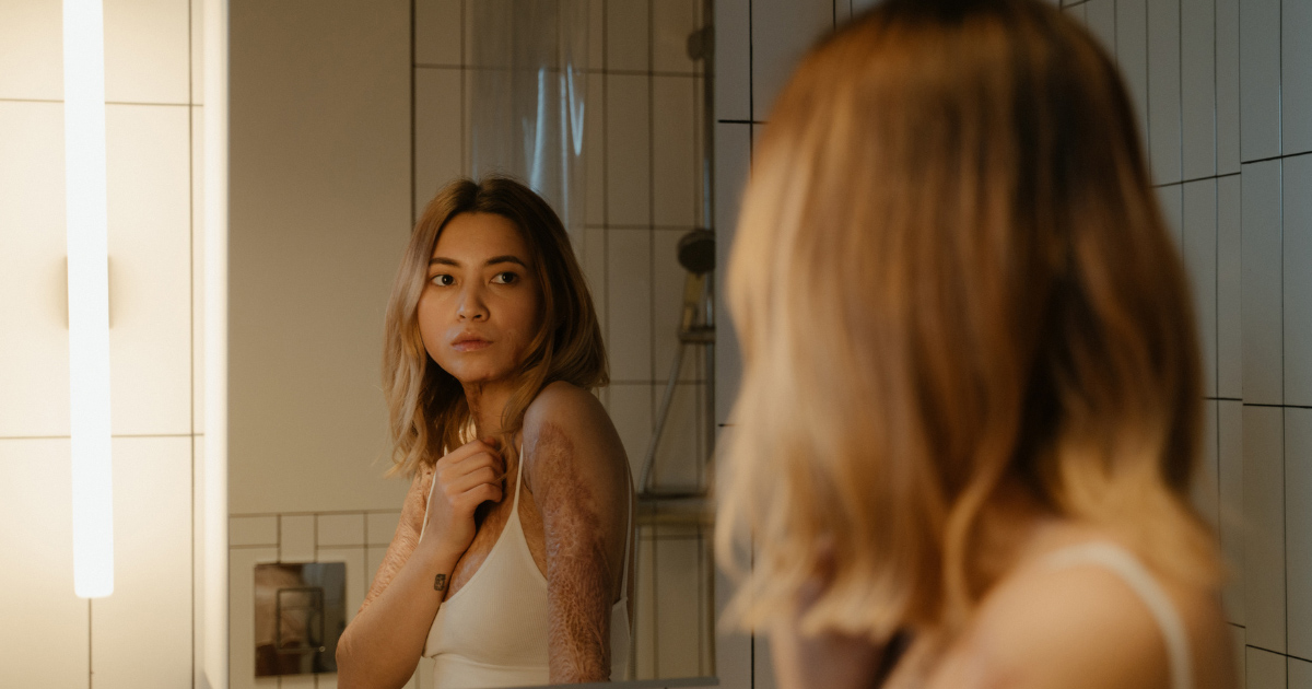 Misconceptions About Scarring and Treatments
