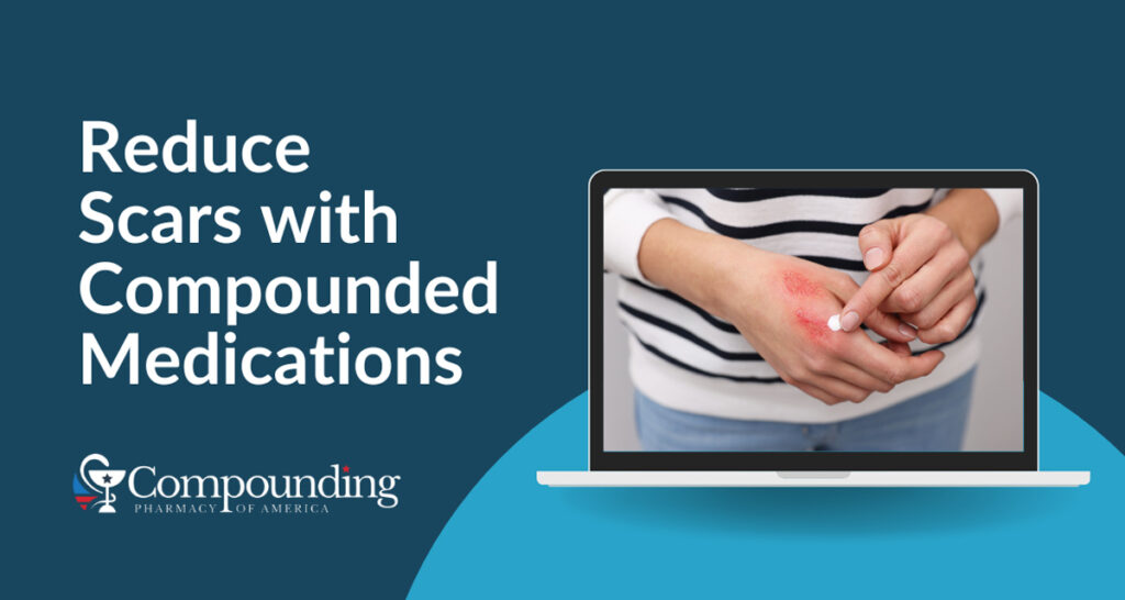 A Guide to Reducing Scars with Compounded Medications